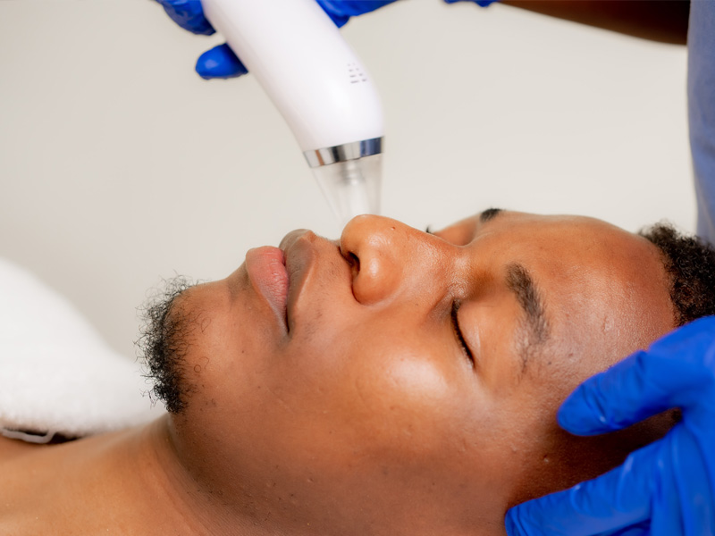 Ultrasound Cavitation