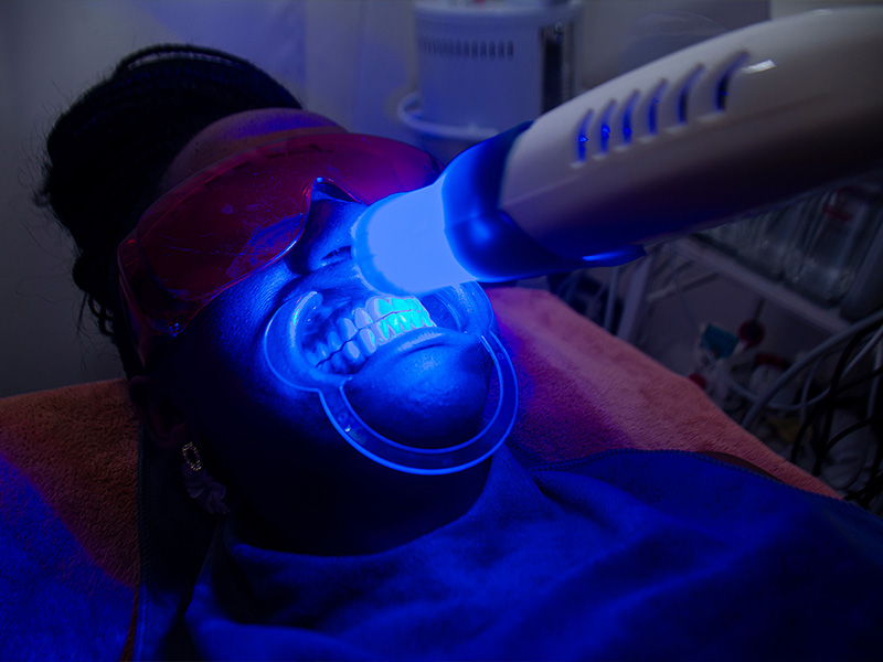 Teeth Whitening